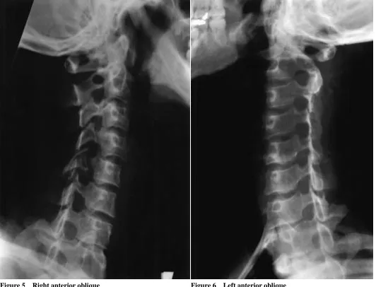 Figure 5Right anterior oblique