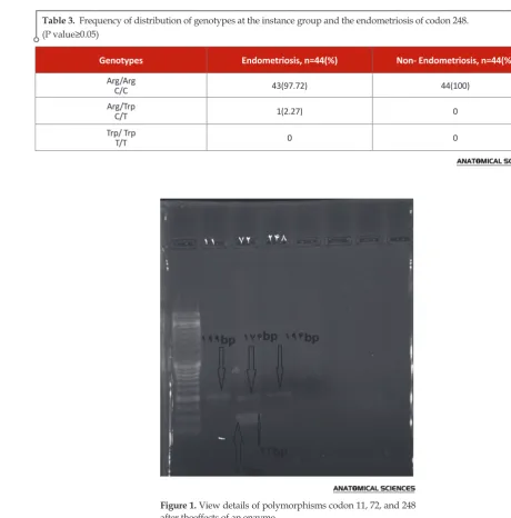 Figure 1. View details of polymorphisms codon 11, 72, and 248 after theeffects of an enzyme.