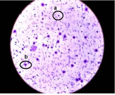 Figure 1. Image of patient's semen in LFG. (a) sperm with large halo; (b) sperm with medium-sized halo