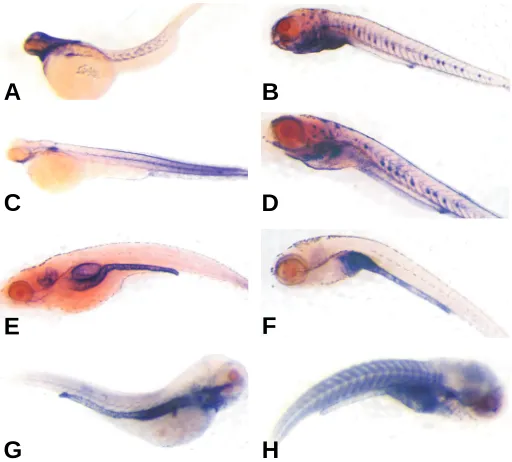 Fig. 2. srf  mRNA expression in developing zebrafish. Day 3 Methods with antisense riboprobes to for whole mount in situ hybridization as described in Materials andand day 7and (A,C,E,G) (B,D,F,H) developing zebrafish embryos/larvae were preparedsrf1 (A,B)