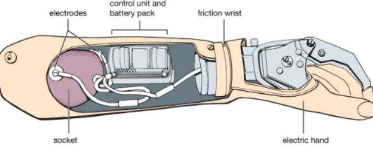 Table 1.1: Functional classification of upper limb prosthesis