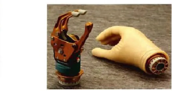 Figure 1.2: Example of myolectric and tri-digit prothesic hand