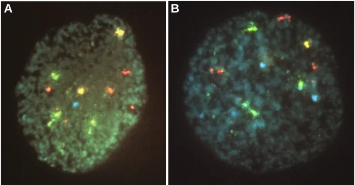 Fig. 3. Fluorescent in situ hybridization analysis of a blastomere from a triploid embryo
