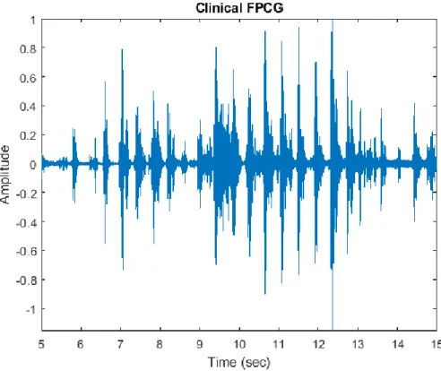Figure 2.1: Clinically acquired FPCG. 