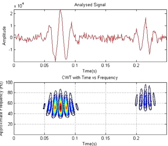 Figure 2.3: Time- frequency representation of simulated FHS. Data obtained from [8] [9]