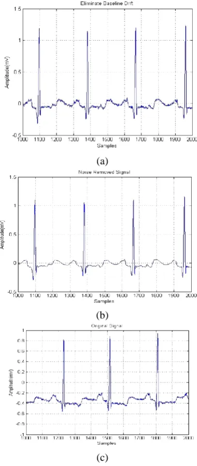Figure 2. Preprocessing results taken on record 100.dat from MIT-BIH cardiac arrhythmia database (a) original signal, (b) baseline elimination, (c) removal of noise 