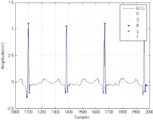 Table 3 condenses the search intervals used to discover ECG segments. It demonstrates the records of the begin and the end scopes of the search [19]