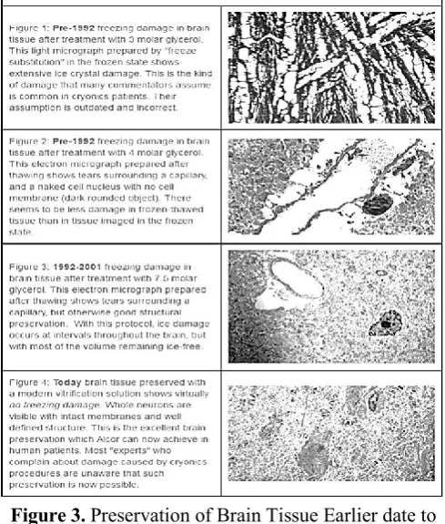 Figure 3. Preservation of Brain Tissue Earlier date to 