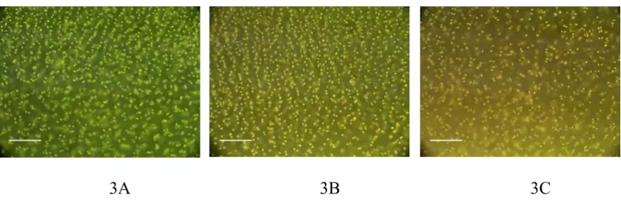 Figure 3Digitised images of the three different cartilage slice sections from which the histograms in Figures 1 and 2 were generated