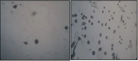 Fig. 3& 4: Photomicroscopic images show the effect of 