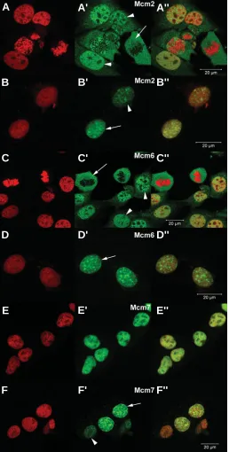 Fig. S2 (Right). Immunodetection of soluble and insoluble Mcm2, -6