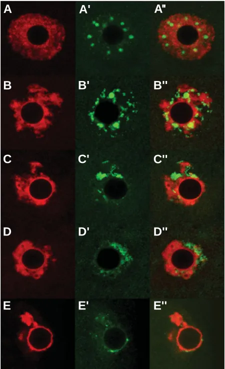 Fig. 2. Distribution of insoluble Mcm2 in the nuclei of growingoocytes (10 dpp).low staining intensity
