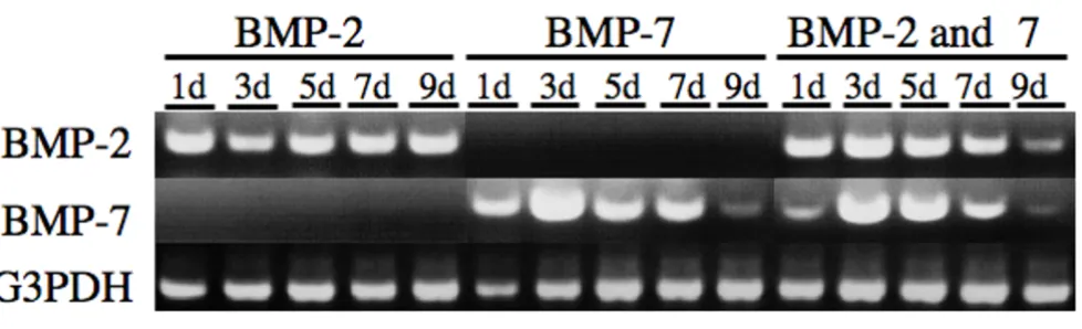Figure 3RT-PCR evaluation of BMP-2 and BMP-7 gene expression after simultaneous gene transfer into skeletal musclesRT-PCR evaluation of BMP-2 and BMP-7 gene expression after simultaneous gene transfer into skeletal mus-cles