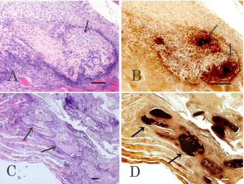 Figure 5in vivo transfected sections (B). Scale bar: 100 Histological analyses 10 days after electroporationHistological analyses 10 days after in vivo electroporation
