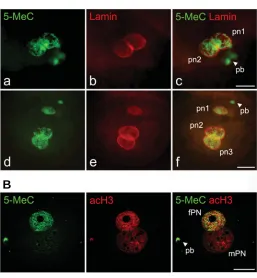 Fig. 1. Immunostaining of pig one-cell eggs for 5-methylcytosine (5-MeC). (A) Scale bar, 20 (v7.0)