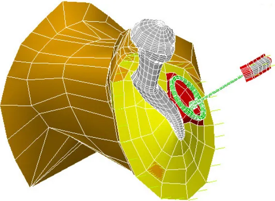 Fig. 4. Mesh of the ossicles in (a) normal configuration and (b) with a large angle between manubruim and stapes