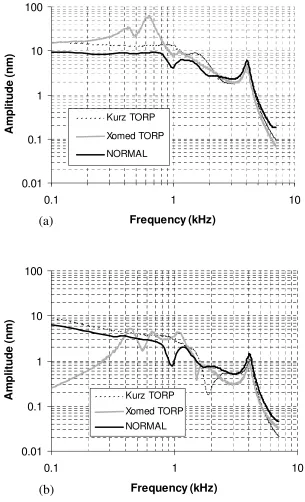 Fig. 8 Finite element predictions for the displacement amplitude of  (a) the umbo 