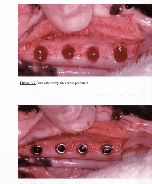 Figure 3.7 Four osteotomy sites were prepared.