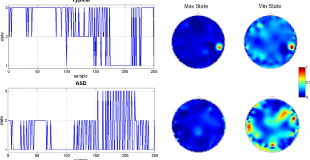 Figure 1: State switching time course and head plots of maximum and minimum occurring  state for a typical and ASD child