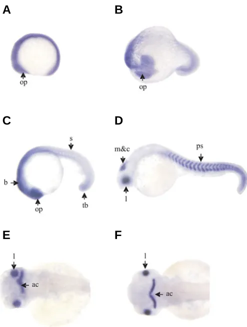 Fig. 3. Overexpression of the EF-2 gene (48 hpf). There is no obviousdifference between the pcDNA3.0-EF2 injected zebrafish and the wildtype zebrafish.