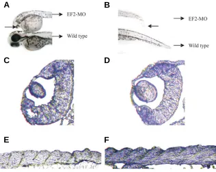 Fig. 4. Morphological and histological analysis of EF2-MO injected embryos at 48 hpf.normal lens development