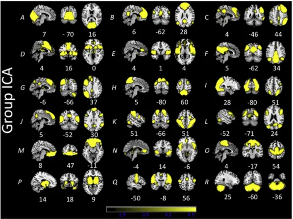 Fig. 1. Functional networks observed in an overall group of 108 subjects (18 from each age group) using ICA.