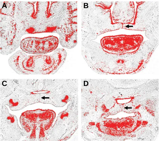 Fig. 3. Tbx1 expression in the craniofacial region of the developingmouse embryo at E14.5 (A-D).of the fused palatal shelves and the pharyngeal endoderm and mesodermmolar tooth germs  Tbx1 is expressed in the incisor and(A,C), epithelium of the nasal cavity (A,B), epithelium(B-D) including the midpalatal seam (arrowed) (D).