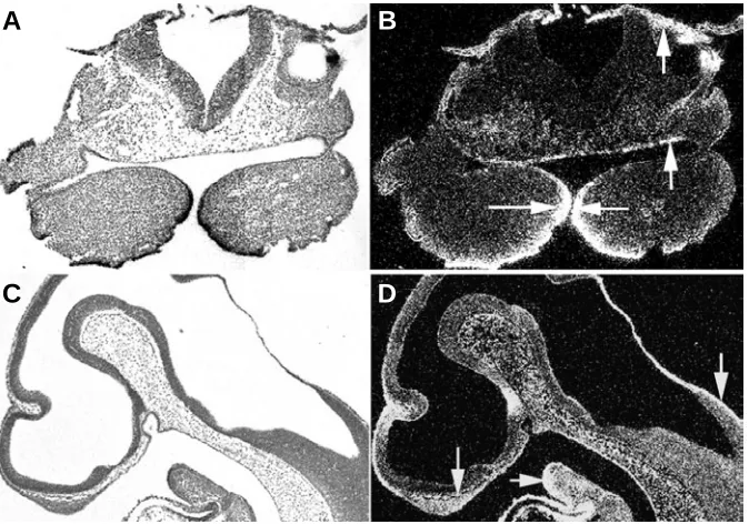 Fig. 1. Bmp4 expression in the developing mouse head at embryo day 10 (E10) localizedby radioactive in situ hybridization.field section; the first branchial arches, stomodeum and ectoderm of cranial neural crest (arrows)