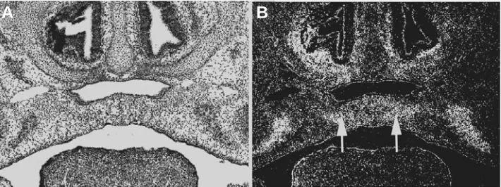 Fig. 3. Expression of Bmp2 in palatogenesis. adjacent to the midline during palatal fusion (arrows)