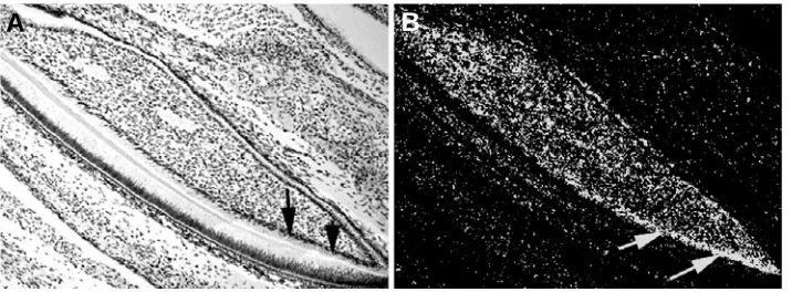 Fig. 4. Bmp2 expression in the mouse incisor in the lower jaw at newborn stage. Intenseexpression is seen in odontoblasts near the tooth root