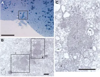 Fig. 3. A semi-thin (2 µµµµµbars; 50 areas, are indicated in the square. the granules indicated in (A)