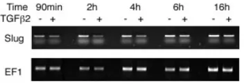 Fig. 8. Downregulation of Slug  with TGFβββββincluding both the otic epithelium and CVG and subjected to RT-PCR withfrom E10.5 embryos were cultured with or without TGFwhether Slug is involved in size increase of the CVG,  Slug expressionlevels were analyz