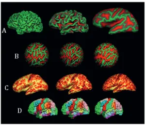 Fig. 2. Illustration of FreeSurfer methods for cortical analyses A) Visualization of structural anatomy, B)  Intersubject registration, C) Cortical thickness statistical maps of point-by-point measurements and D)  Parcellations into functionally regional r
