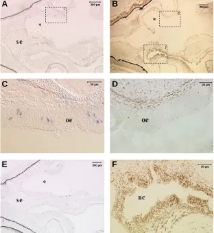 Fig. 2. Comparison of COR  gene expression in ipsi- and contro-lateral sides of ED14