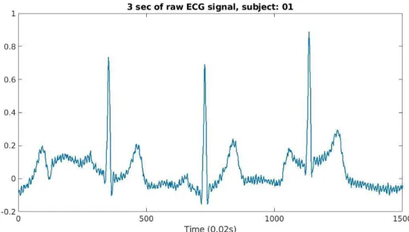 Figure 3.3 Raw ECG wave 