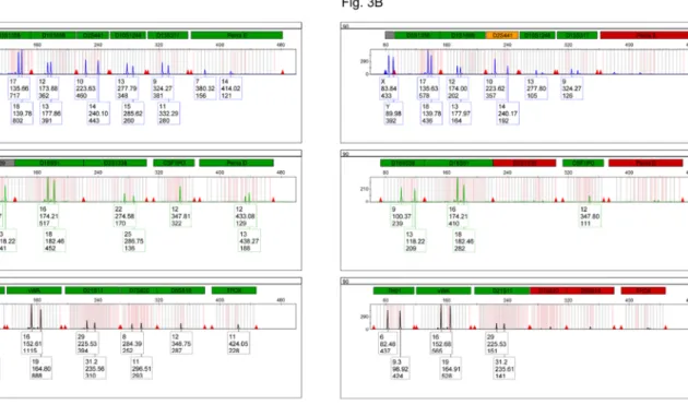 Fig 3. Electropherograms of 2800M gDNA heat-degraded for different times and amplified with PowerPlex ® Fusion 6C for 29 or 35 cycles
