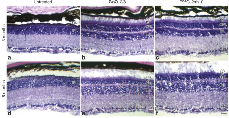 Figure 4 Analysis of retinal morphology following hematoxylin and eosin staining in RHO-2/8 and RHO-2/rh10 transduced retinas in Rho–/– mice
