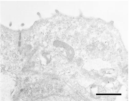 Fig. 5. Cytochemical control. Immunoelectron microscopic study of thecolloidal gold labeling was observed