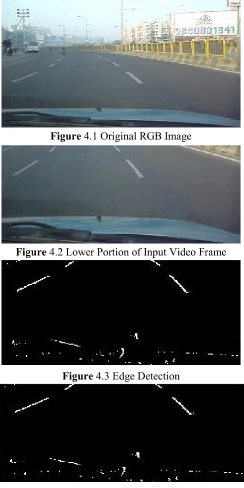 Figure 4.4 Binary Image 