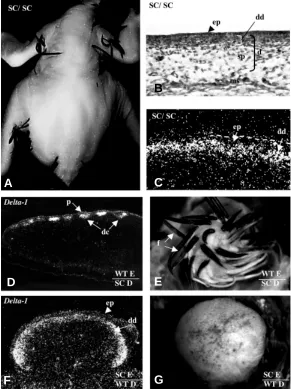 Fig. 2. The chick scaleless mutant: the formation of dermal condensations isaffected due to a deficiency in epidermal signalling