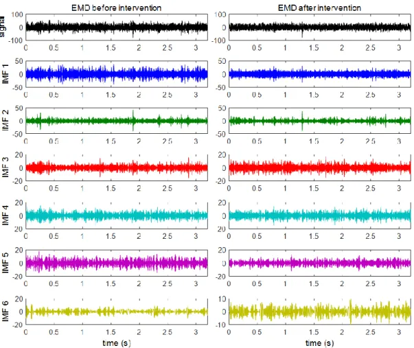 Figure 8. The original signal (in black) and the first six IMF (in different colours) of vertical vibration  signals before and after maintenance