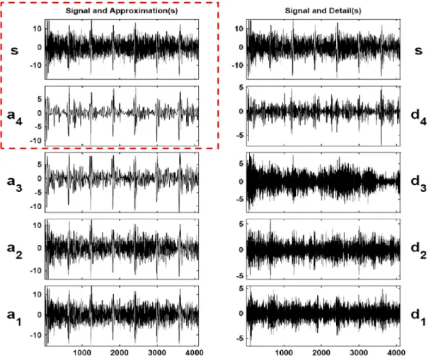 Fig. 5. Wavelet decomposition (Approximation(s) and Detail(s)) up to fourth level using Symlet5 wavelet for the vibration signal with outer race  defect of diameter 1.298 mm