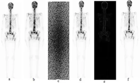 Figure 7. The result images from the steps followed to achieve the proposed algorithm, (a) original image, (b) the result image from prepossessed (c) the result image from Fourier transform, (d) the result image from convolution, (e) the result image from 