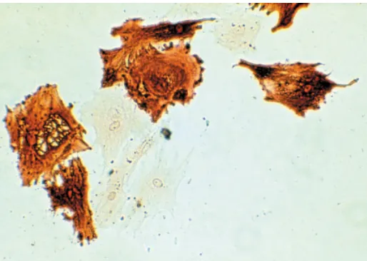 Fig. 1. Expression of the chicken δδδδδof synthesis of cells expressed this crystallin strongly, as shown in this figure