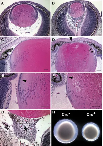 Fig. 4. Sections through the eyes of Alk3 flox/floxwould normally be the anterior chamber (arrowhead)