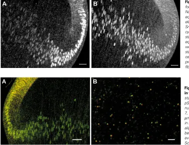 Fig. 8. The distribution of pSMAD1-2 stainingin the lens.µScale bar represents 10 every vesicle is stained by both antibodies.7, and in cytoplasmic vesicles (Scale bar is 25nuclei, showing the same distribution as in Fig.been shifted by 2 pixels, showing t