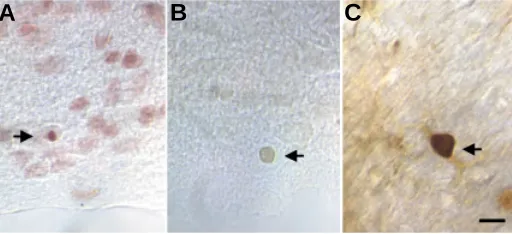Fig. 2. Three different methods to visualize apoptotic cells. (A) Feulgenvisualized with the different methods