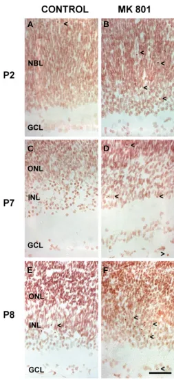 Fig. 3. The effect of MK-801 on cell apoptosis in the rat retina at differentdevelopmental stages