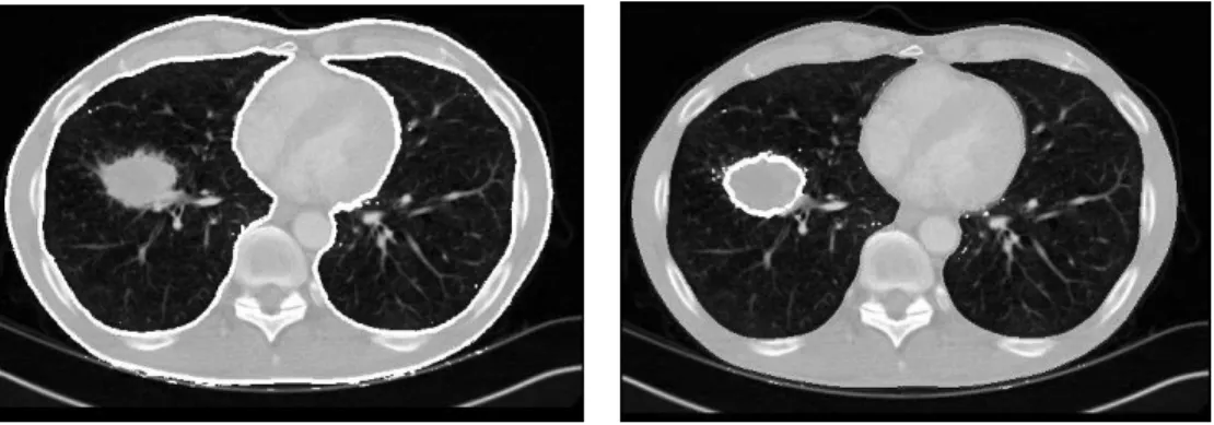 Figure 2.2: Sample CT-Image Slice