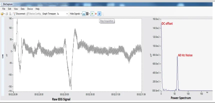 Figure 2.7 Raw signal and its Power Spectrum depicting the DC oﬀset noise and 60 Hz noise in a Channel(screen shot from the Bio-Capture Software) [5]